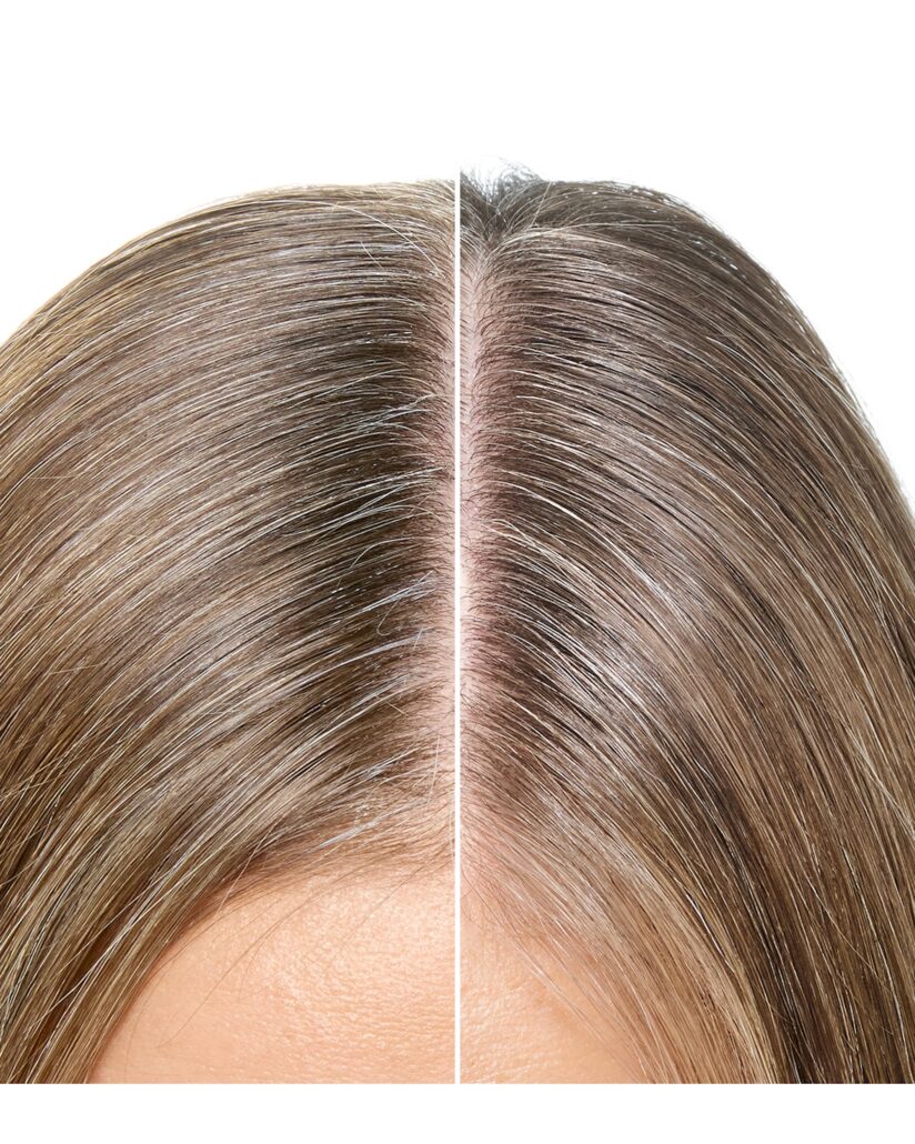 R LP BLENDING 2025 BEFORE AFTER FRONT ROOT T6 BETTER 4x5 RVB MULTIPLE EAN VI
