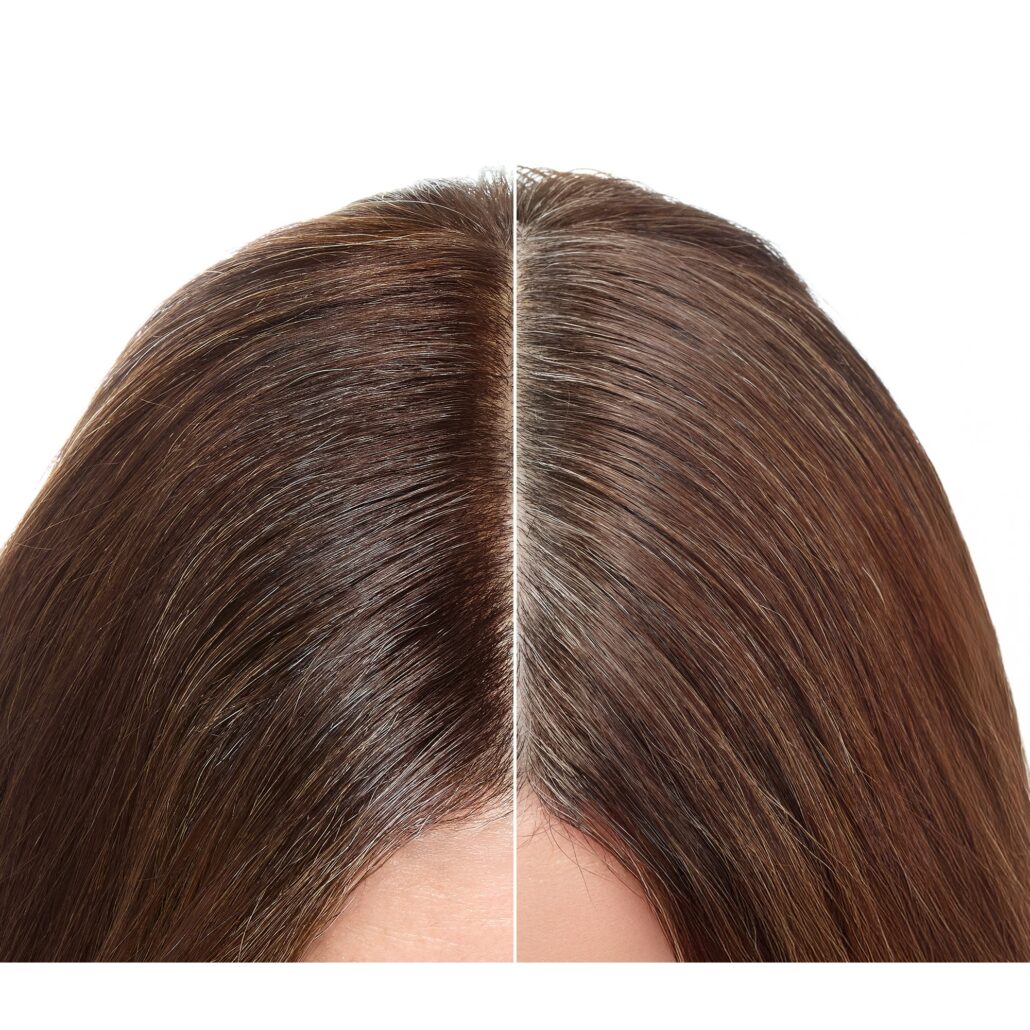 R LP BLENDING 2025 BEFORE AFTER FRONT ROOT T6 GOOD 1x1 RVB MULTIPLE EAN VI